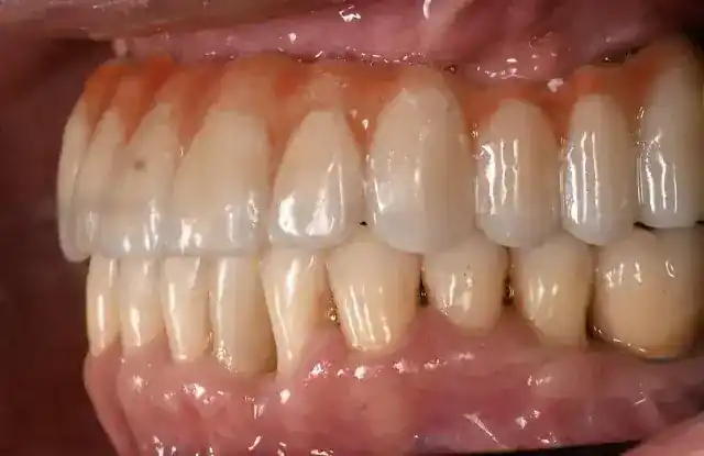 Barsoum Dental
