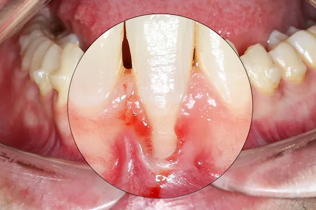 Bayside Periodontics