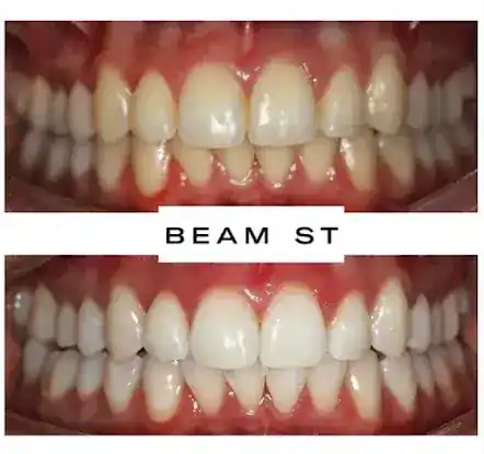Beam Dental