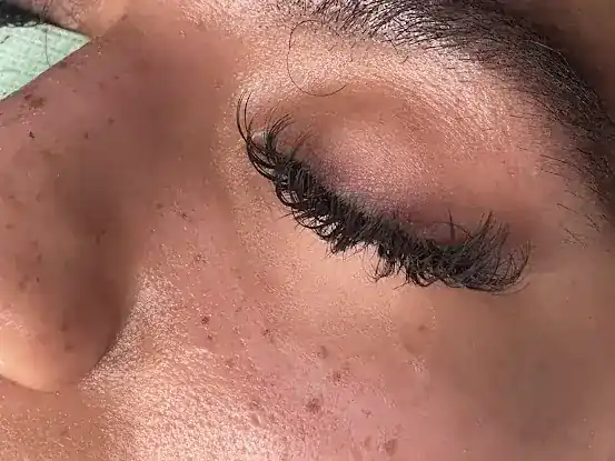 Blinkalicious