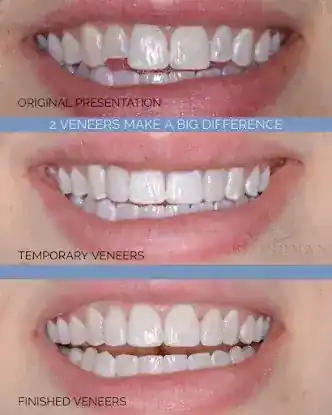 Blondman Dental