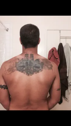 Brooklyn Laser Tattoo Removal, Inc.