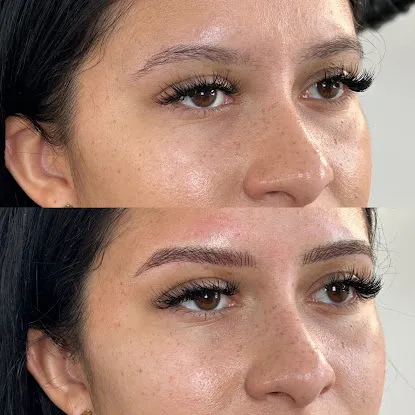 Browstress