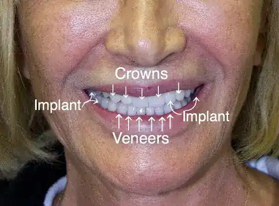 Dr. Horri Aesthetic Reconstructive Dentistry
