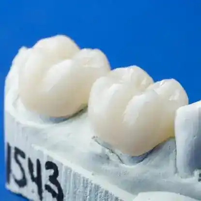 Elegant Dental Laboratories