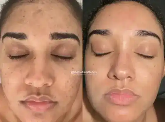 Emerald Isle Esthetics