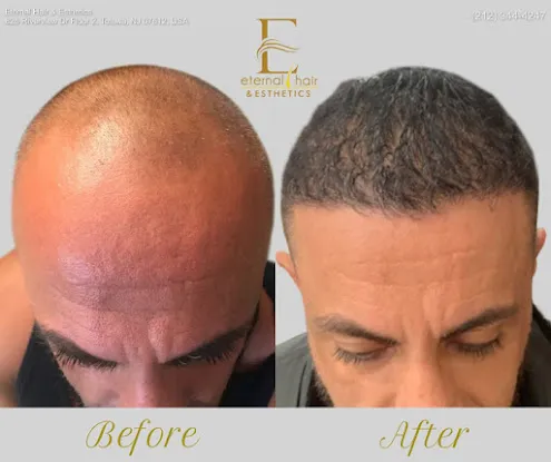 Eternal Hair & Esthetics