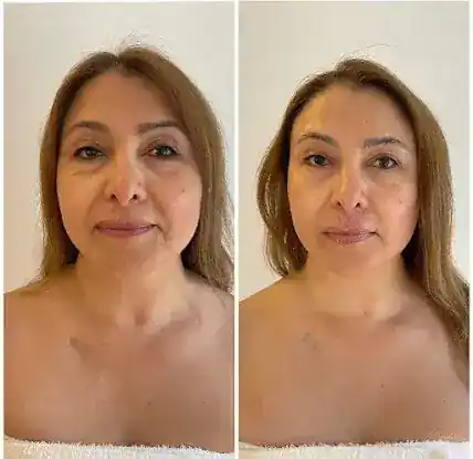 Facie Studio