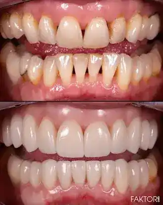 FaktorDMD Cosmetic Dentistry & Implants - NYC