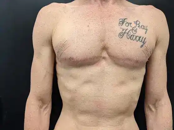 Friday Jones Medical Tattooing