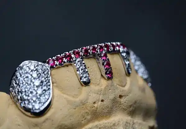 Grillz Gold Teeth | Gabby Elan Jewelry