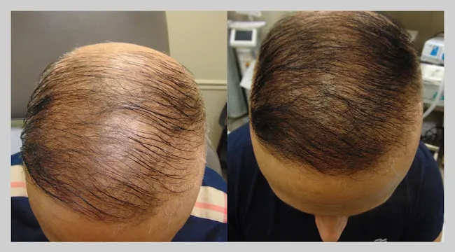 Hair Institute in New Jersey