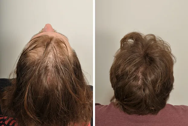 HairCareMD