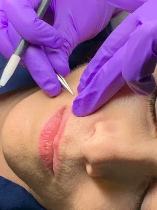 Hairfree NYC Electrolysis Hair Removal