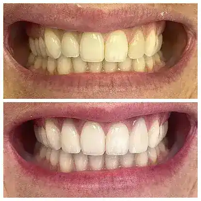 Harrison Street Dental