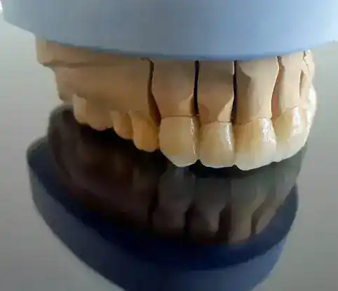 Image Dental Laboratories | Milling Center