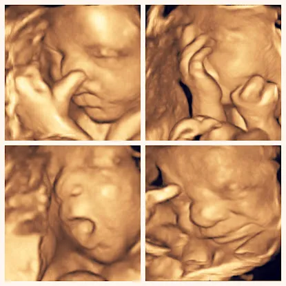 In The Womb NYC 3D/4D Imaging - AT HOME ULTRASOUND SERVICE
