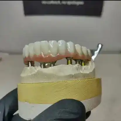 Interstate Dental Laboratories
