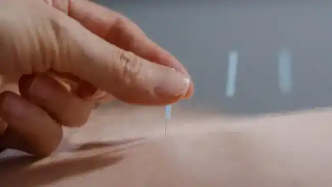 Kelly 121 Acupuncture