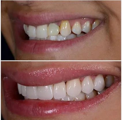 Les Belles Dentistry