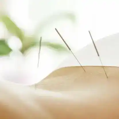 LouLou Piscatore, L.Ac. - Integrative Acupuncture