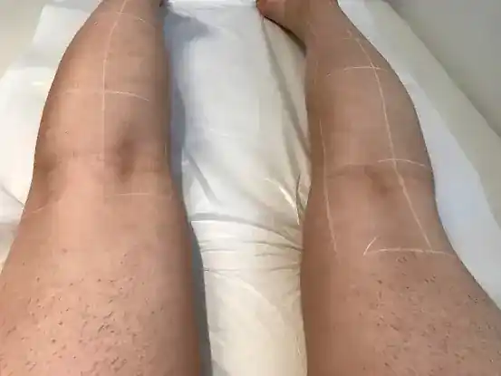 Manhattan Laser Centers