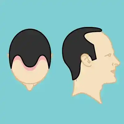 MAXIM Hair Restoration