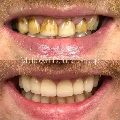 Midtown Dental Group Upper East Side