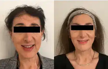 Nicholas Bastidas, MD - Plastic Surgery