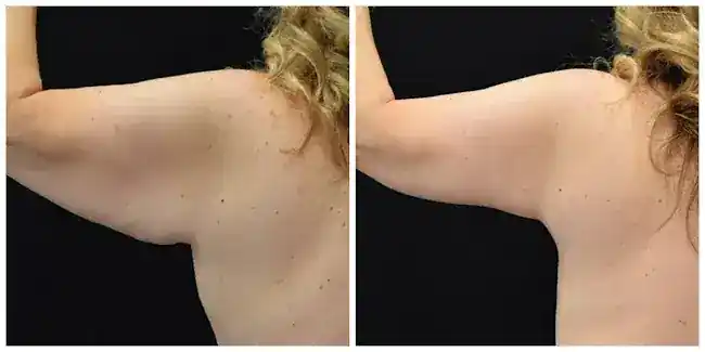 NYBG Plastic Surgery