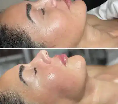 NYC Oasis Buccal/TMJ Spa