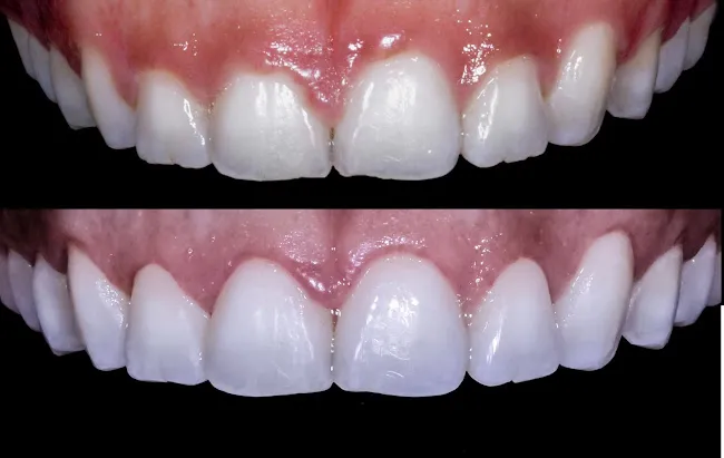NYC Smile Spa