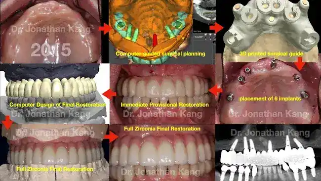 Plaza Dental Implant Center