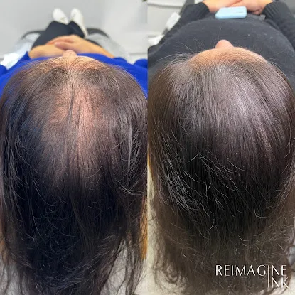 Reimagine Ink - Microblading & Scalp Micropigmentation NYC