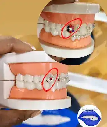 Smile Bigger with Danni:Teeth Whitening & Tooth Gems