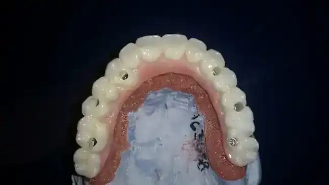 The Dental Laboratory Group