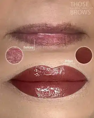 THOSE BROWS