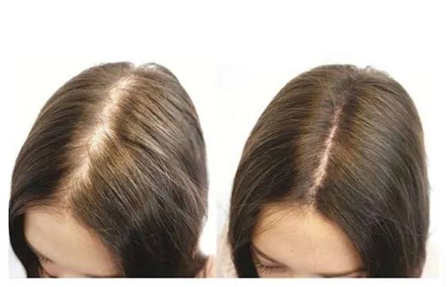 Trichologist NYC - Expert Hair & Scalp Care at 629 Park Ave, New York, NY