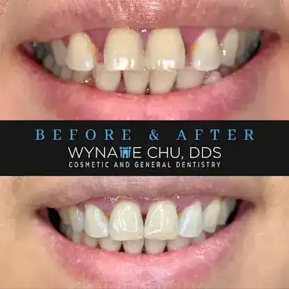 Wynatte Chu, DDS