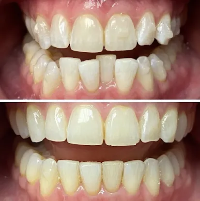 Zen Dentistry - FiDi
